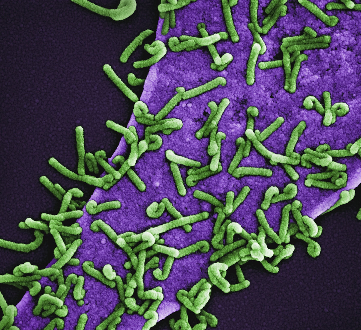 a close up of a purple and green substance